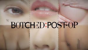 Botched: Post Op — foto 1