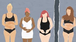 MUM Misunderstandings of Miscarriage — foto 12