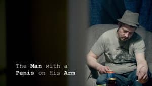The Man With a Penis on His Arm — foto 1
