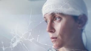 My Brain: After the Rupture — foto 1