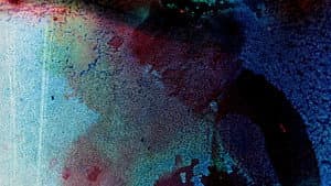Pigment-Dispersion Syndrome — foto 3