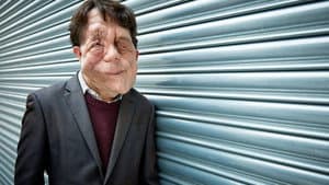 The Ugly Face of Disability Hate Crime — foto 1