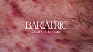 Bariàtric — foto 1